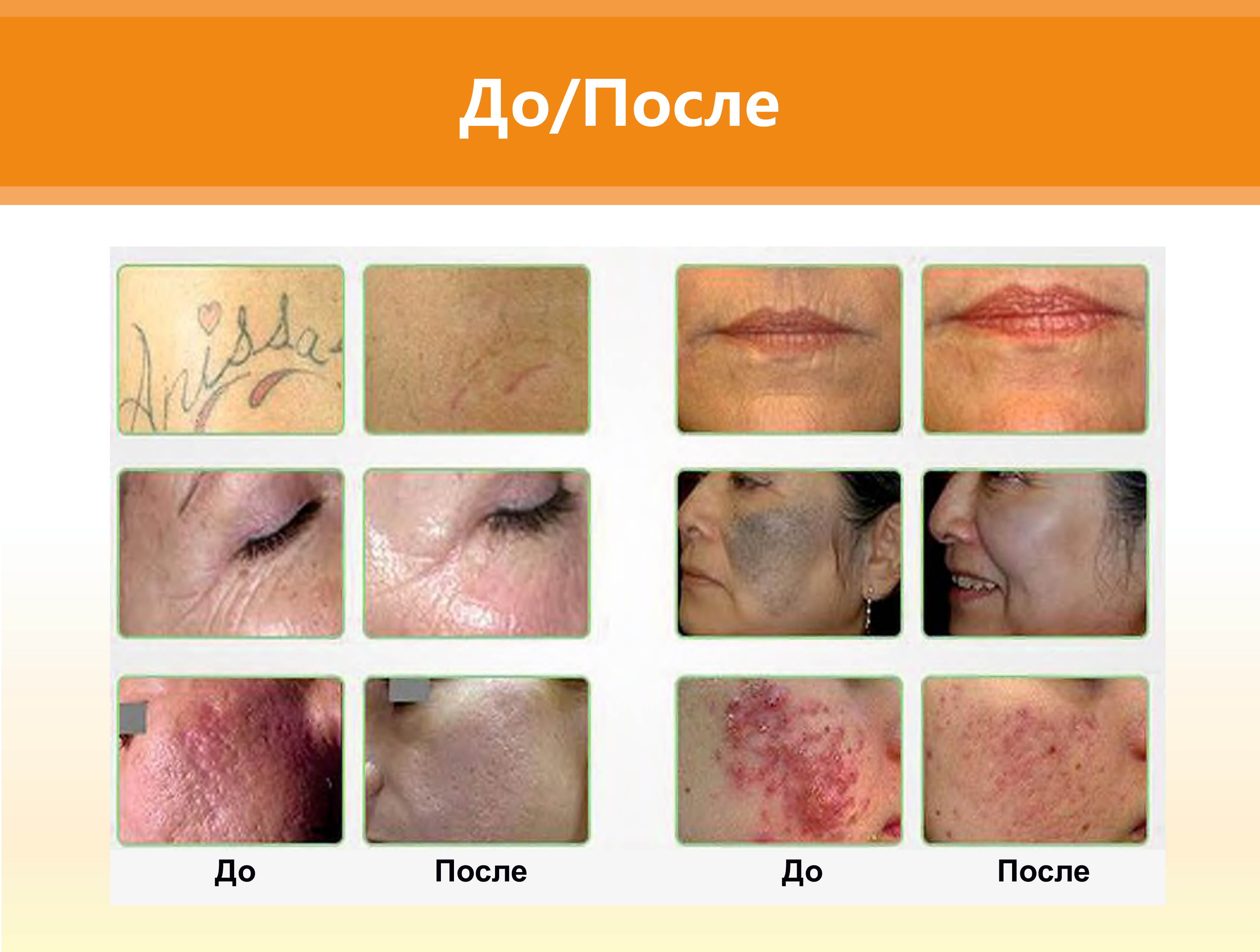 Клинические результаты Клинические результаты
