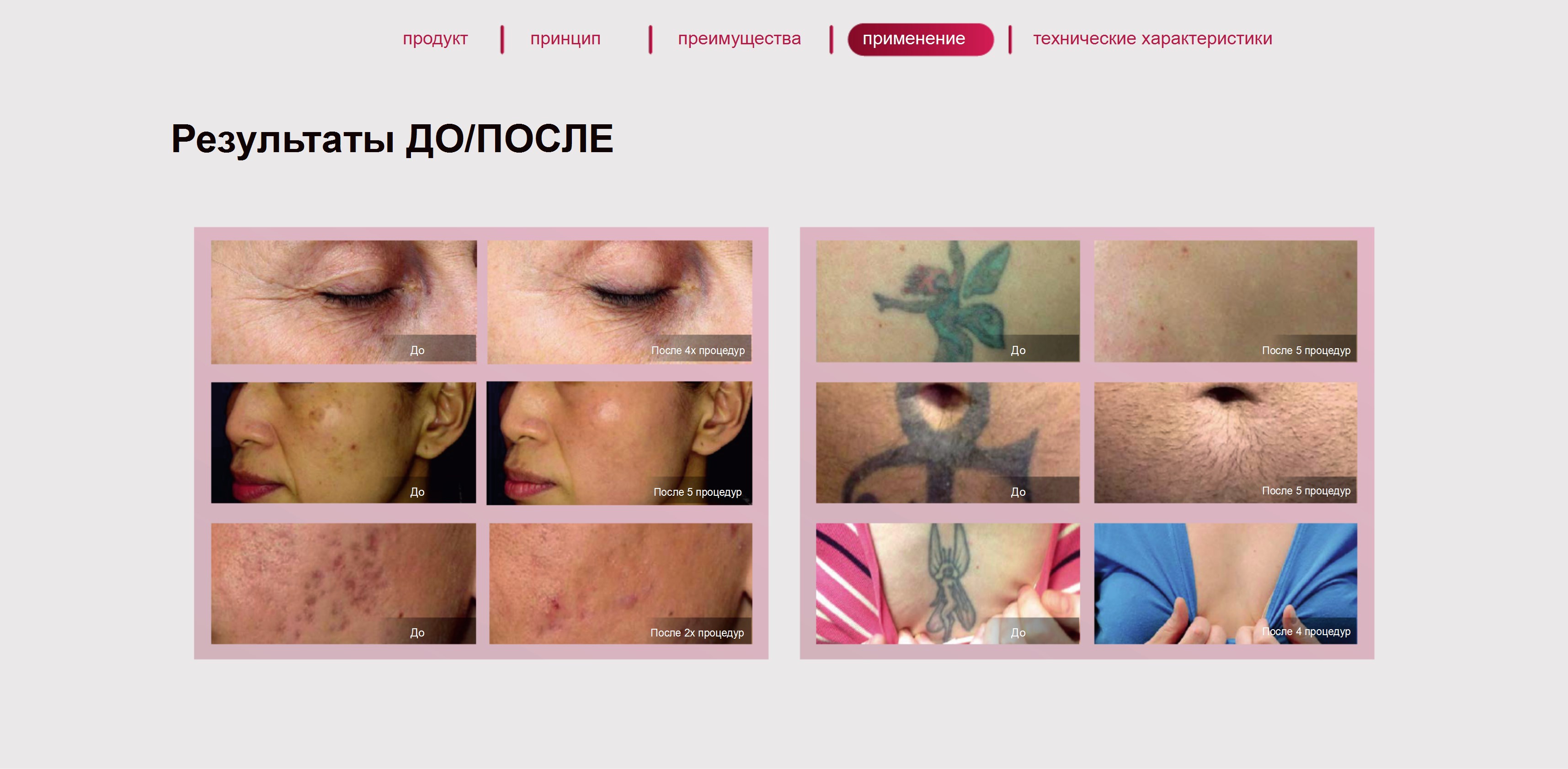 Фотографии результатов до и после процедур Фотографии результатов до и после процедур
