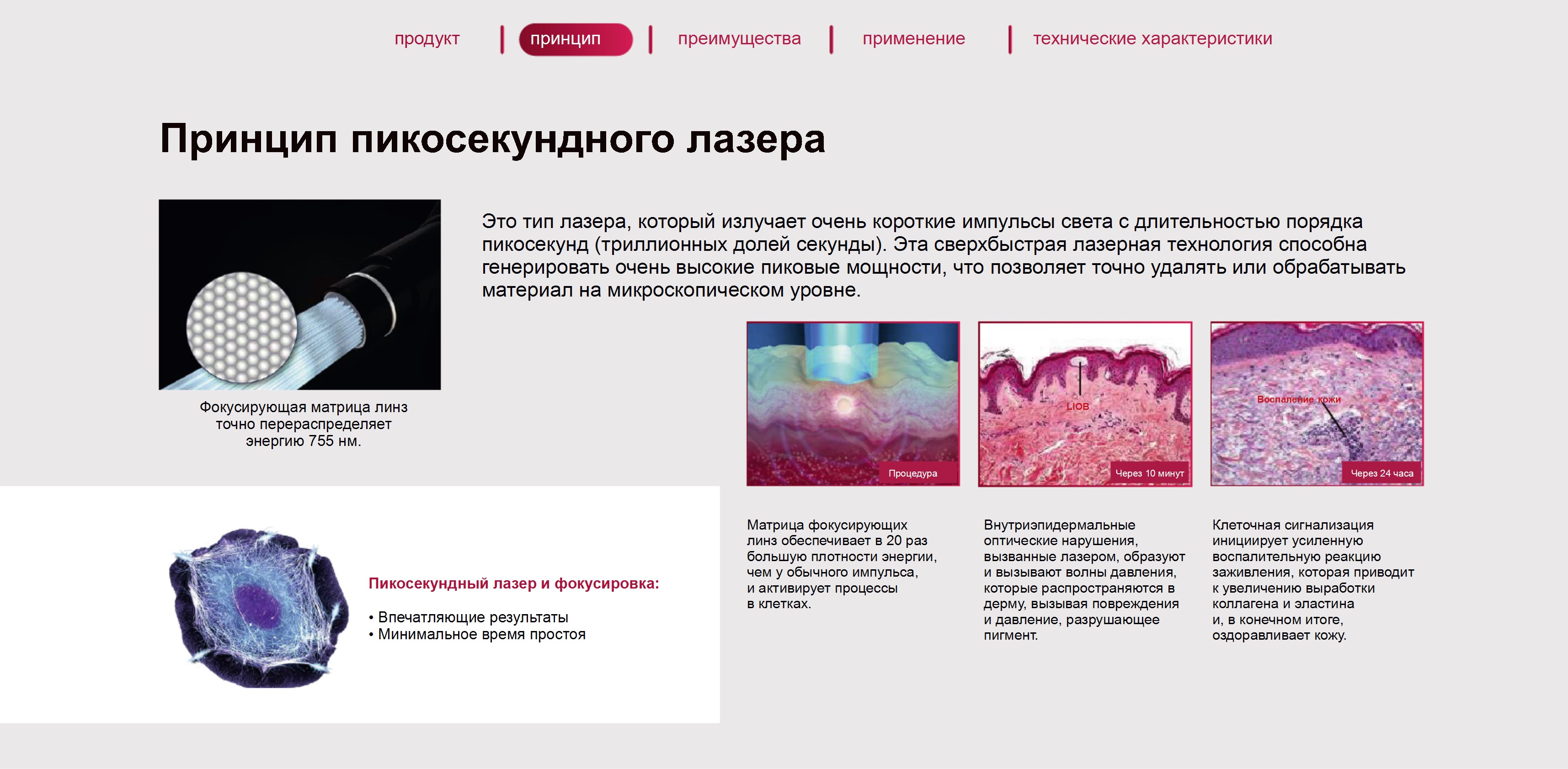 Схема принципа работы пикосекундного лазера Схема принципа работы пикосекундного лазера