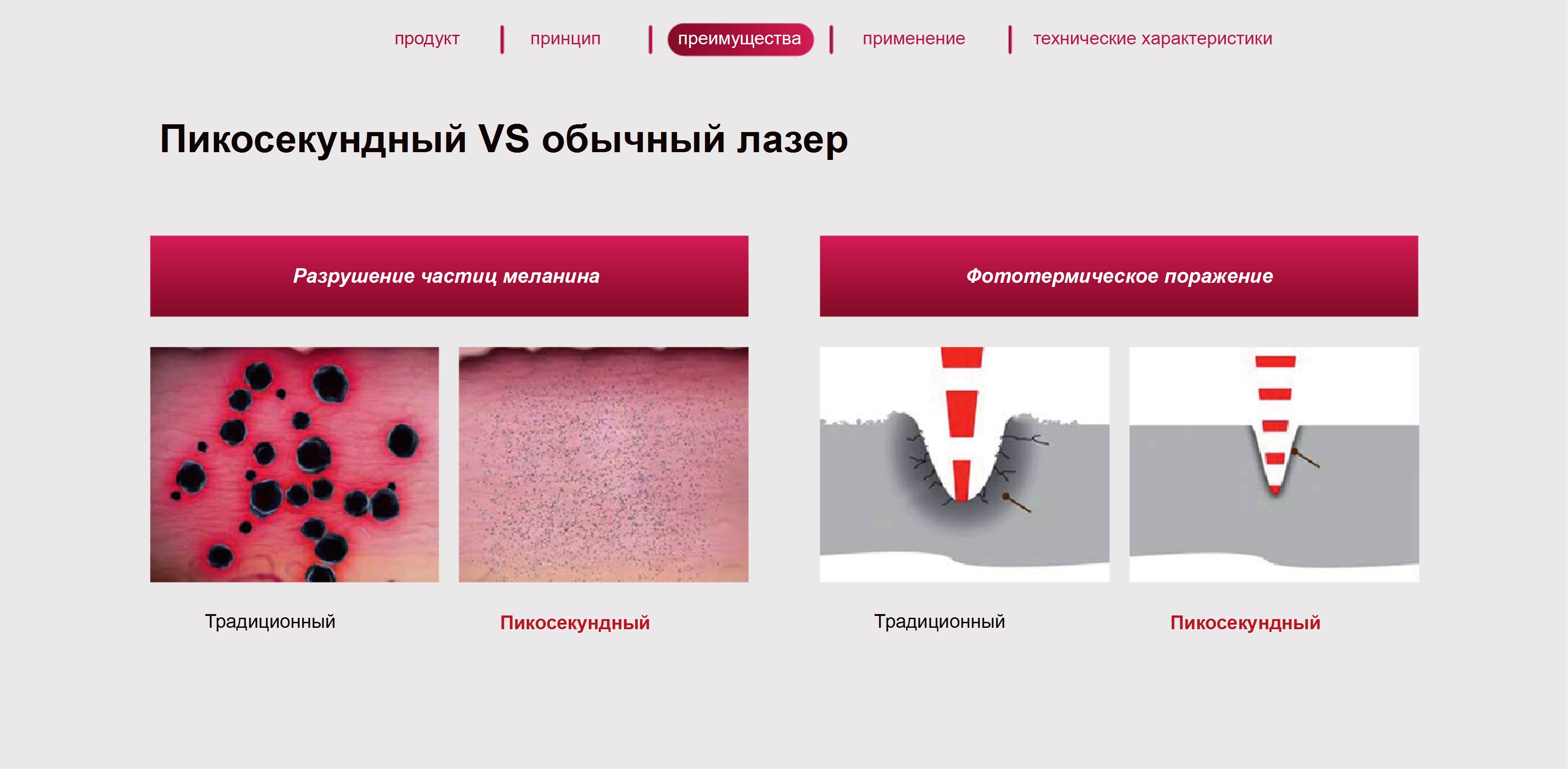 Сравнение пикосекундного и обычного лазера Сравнение пикосекундного и обычного лазера